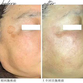 最新シミケアLily de pearlのエステ・リラクイメージ