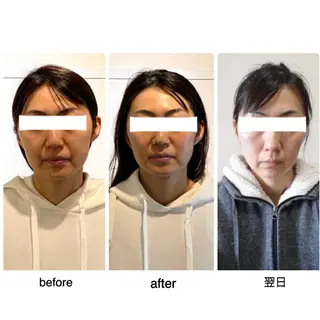 ロング カラー ネイル マツエク・マツパ 小顔矯正専門サロンジュマリ所属・町田 淳子のエステ・リラクイメージ