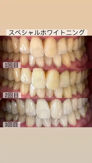 whitening salon yatto.所属・ホワイトニングサロン yatto.のその他イメージ
