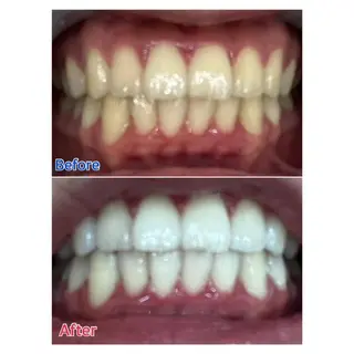 MBEAUTYSALON 千葉店・京成大久保所属・Melty 輝のその他イメージ