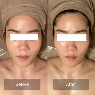 Ｂ&H所属・頭痛•肩こり専門/ 眉サロンB&H心斎橋のエステ・リラクイメージ