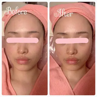 透明感の肌Lino malieのエステ・リラクイメージ