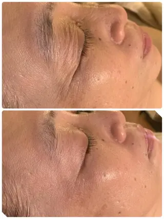 esty hitomiのエステ・リラクイメージ