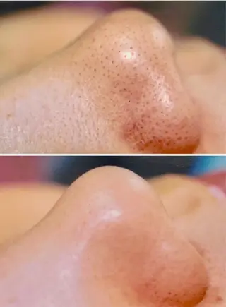 メルシー13所属・トータル美容サロン☆ 脱毛/小顔/毛穴洗浄のエステ・リラクイメージ