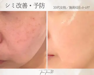ピーリング×肌管理 THREETHREEのエステ・リラクイメージ