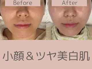 べアール所属・小顔/毛穴/白玉肌 salon bealのエステ・リラクイメージ