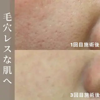 小林 千紘のエステ・リラクイメージ