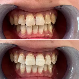 セルフホワイトニング Shineeのエステ・リラクイメージ