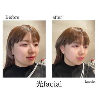 🎀kaede🎀 骨格似合わせ眉毛の眉毛・アイブロウイメージ