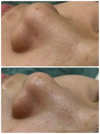 脱毛&フェイシャル 専門店muro.のエステ・リラクイメージ