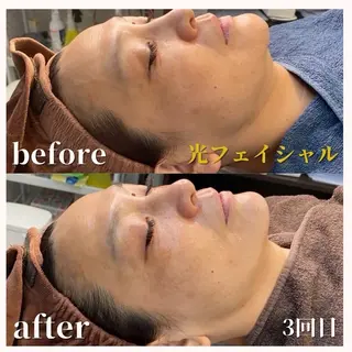 脱毛 Beauty salon Lumiere(ルミエール)所属・完全都度払い脱毛⭐︎ Lumiereのエステ・リラクイメージ