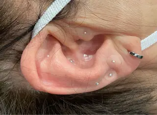 LiZA エステティックサロンのエステ・リラクイメージ