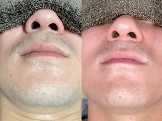 エステサロンTug高知駅前店所属・Tug 高知駅前店/ NANAMIのその他イメージ