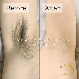 メンズ 🌸🧡六本木 脱毛しずか🧡🫧の眉毛・アイブロウイメージ