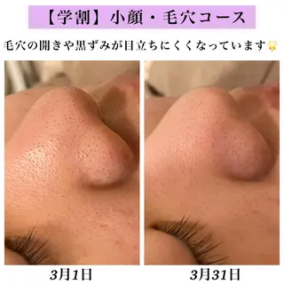 Bellesthe （ベルエステ）のエステ・リラクイメージ