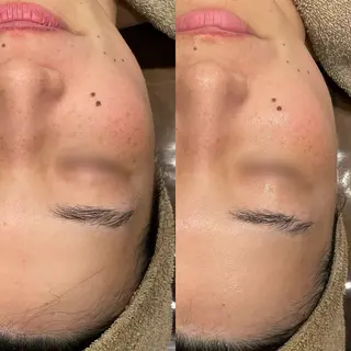 Re:Belle所属・Re:Belle 久留米 : 中島のエステ・リラクイメージ