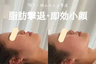 最速小顔・肌質管理 ❣️エスポワールのエステ・リラクイメージ