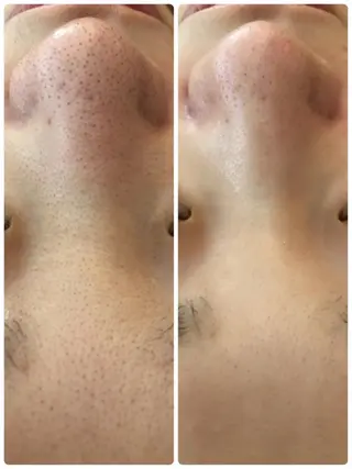 Beauty Maxのエステ・リラクイメージ