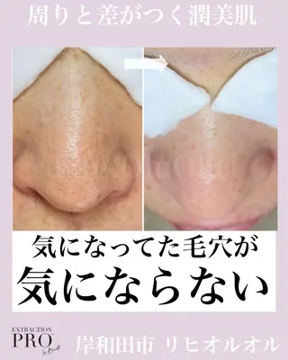 毛穴汚れ改善専門店/ 岸和田/リヒオルオルのエステ・リラクイメージ