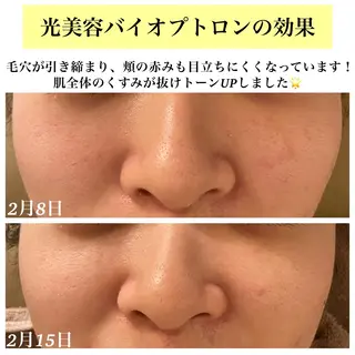 Bellesthe (ベルエステ)のエステ・リラクイメージ