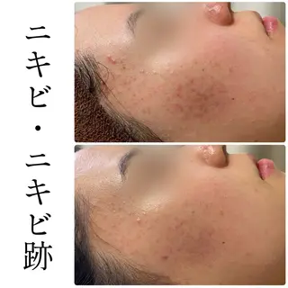 ハーブピーリング専門 BIOEL横浜のエステ・リラクイメージ