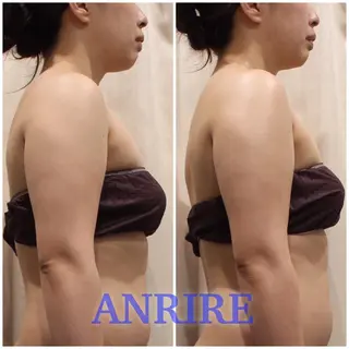 ANRIRE (アンリール)のエステ・リラクイメージ