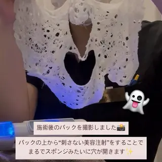 MORE BEAUTY ESTHE 本通り店所属・【シミ・シワ専門店】 山本 藍美のエステ・リラクイメージ