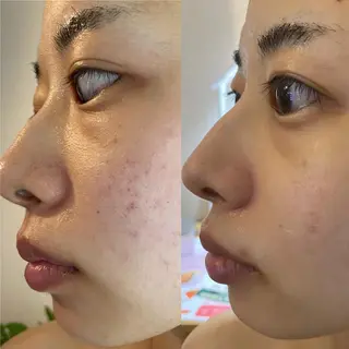 Meetite 小林のエステ・リラクイメージ