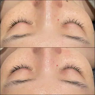 LiZA エステティックサロンのエステ・リラクイメージ