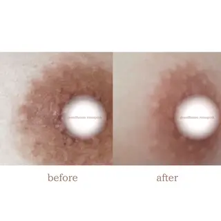 本気で痩せたい方へ 痩身専門サロンのその他イメージ