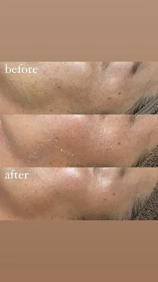 brilliance所属・老化肌トラブル肌専門 Brillianceのエステ・リラクイメージ