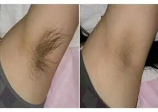 林 萌えのマツエク・マツパデザイン