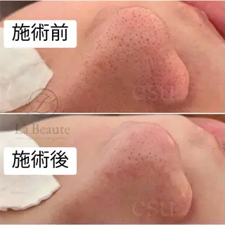 毛穴ケア専門店 esu(エス)のエステ・リラクイメージ