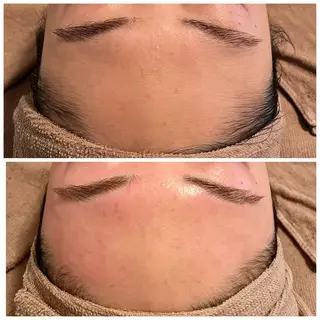 B&H所属・頭痛•肩こり専門/ 眉サロンB&H心斎橋のエステ・リラクイメージ