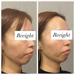 肌質改善専門 ハーブ /毛穴洗浄 リエイトのエステ・リラクイメージ