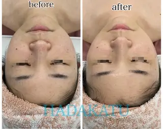 総合エステサロン 肌活のエステ・リラクイメージ