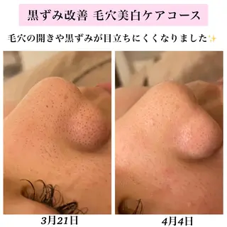 Bellesthe （ベルエステ）のエステ・リラクイメージ