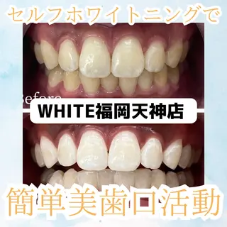 メンズ ホワイトニング専門店 WHITE天神店のエステ・リラクイメージ
