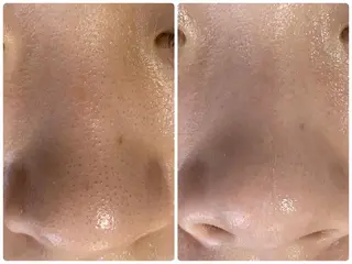 De I'm トータルビューティーサロン所属・COCO beautyサロンのエステ・リラクイメージ