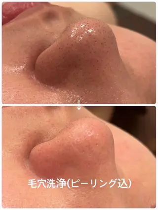 【LEPUS】 nishimoriのエステ・リラクイメージ