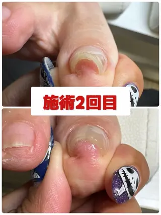 ネイル Eri nail所属・nail salon -TOIRO-のネイルデザイン