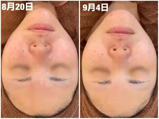 パーソナル肌質改善 🦋APRI🅿️有のエステ・リラクイメージ