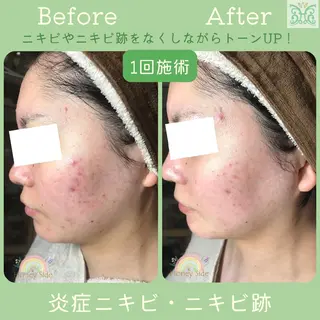 剥離するハーブ🌈 Honey Sideのエステ・リラクイメージ