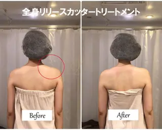 痩身×フェイシャル ブライダル|Linoのエステ・リラクイメージ