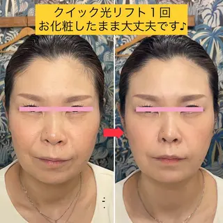 ラ・レーヌ・デ・シャ 平野のマツエク・マツパデザイン