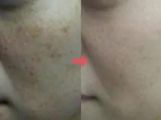 横浜エステサロン R-ing リングのエステ・リラクイメージ