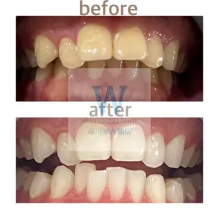 ホワイトニング ショップ本八幡店のエステ・リラクイメージ