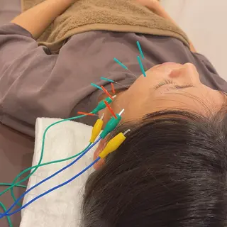 美容鍼灸Solana所属・肌質改善×美容鍼 ゆいのエステ・リラクイメージ