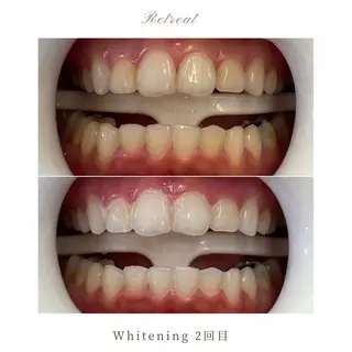 Retreatリトリート所属・歯科医院提携 Retreatのその他イメージ