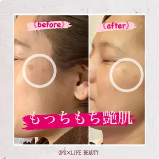 メンズ OPS×LIFE BEAUTY所属・OPS×LIFE BEAUTY/maiのエステ・リラクイメージ